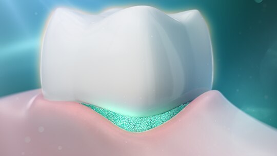 Denti normalmente sensibili