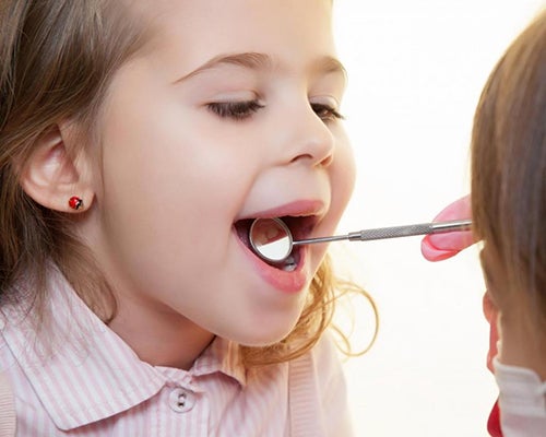 Prevenzione della carie con il fluoro