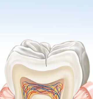 about-karies-tooth1-de.png about-karies-tooth1-de.png