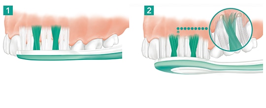 dente sano